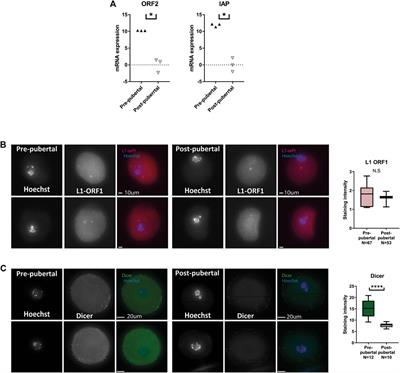 Pre-pubertal oocytes harbor altered histone modifications and chromatin configuration